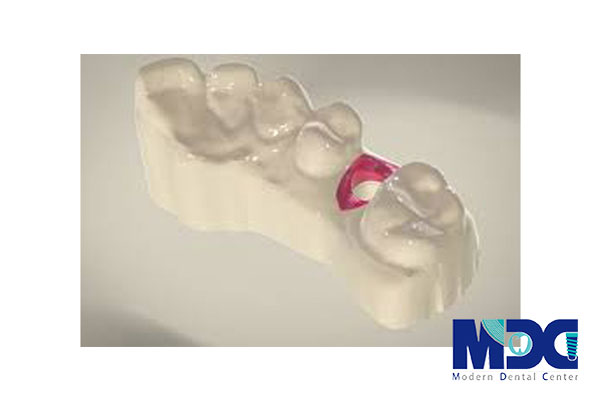 تکنولوژی پرینتر سه بعدی-کلینیک دندان پزشکی مدرن