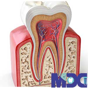 Read more about the article عصب کشی دندان چیست؟ همه چیز درباره درمان ریشه